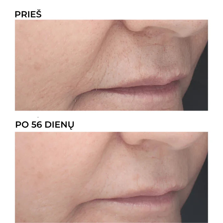 DermEden retinoidų naktinis 6% koncentratas nuo raukšlių RETINAL, 30 ml