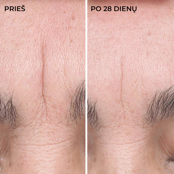 DermEden intensyviai drėkinantis serumas koncentratas HYAL FILLER, 30 ml